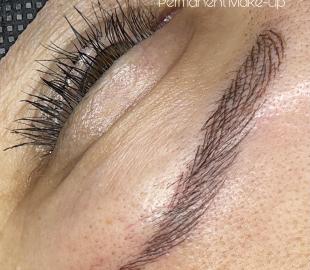 Direkt nach der Behandlung