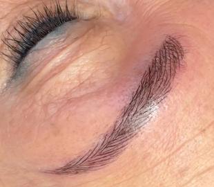 Unmittelbar nach der Behandlung