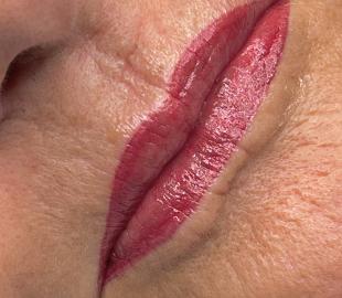 Direkt nach der Korrekturbehandlung